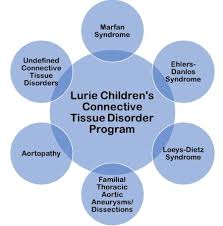 Image result for Connective Tissue Disorder