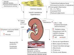 Anemia of chronic disease and renal failure. Metabolic Risk Factors And Renal Disease Kidney International