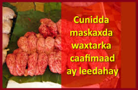 Download.waxtarka toont.com ~ download waxtarka toont com download waxtarka toont com dagaalkii dooxada gobley duleedka xudun ku dhexmay xoogaga khaatumo state iyo. Where Is Pastor Ntia Of Winners Chapel