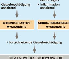 Meistens besteht eine vergrößerung des herzschattens durch dilatation des linken ventrikels (schwimmbeck 2015). Https Www Herzstiftung De Sites Default Files Media Ks29 Myokarditis 2016 Ks29 Myokarditis 2016 Pdf
