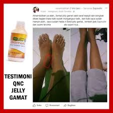 4 jenis penyakit mata emetropia dan penyebabnya. Obat Herbal Kaki Bengkak Karena Jantung Ginjal Diabetes Kolestrol Saat Hamil Gamat Qnc Shopee Indonesia