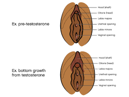 Testosterone HRT and Bottom Growth