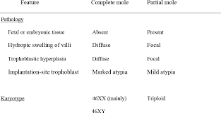 Gestational Trophoblastic Disease Diagnosis And Work Up