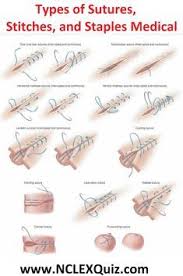 Types Of Sutures Stitches And Staples Medical Surgical