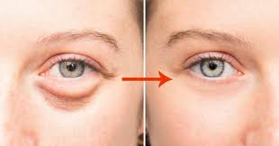 Saglik Panosundaki Pin