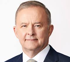 Anthony Albanese