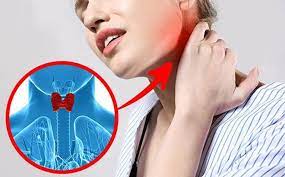 Xuất hiện những dấu hiệu của bệnh lý tăng canxi máu cấp tính hoặc mãn tính với những triệu chứng như buồn nôn, chán ăn, mệt mỏi,… khiến cơ thể nhanh chóng suy. Co 10 Dáº¥u Hiá»‡u Nay NghÄ© Ngay Tá»›i Bá»‡nh Ly Tuyáº¿n Giap Vinmec