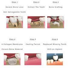 Cosmetic Dentistry 90210 The Best Cosmetic Dentist In Hollywood