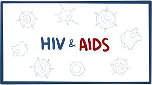 Image result for HIV Presentation