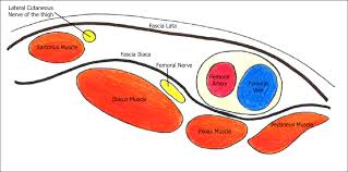 Lateral femoral cutaneous nerve block ultrasound. Femoral Nerve Block Article European Society For Paediatric Anaesthesiology