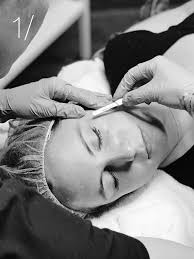 I immediately contacted ******* at krave and asked why i was already charged for a procedure i hadn't even had yet. Facial Aesthetics The Number One Med Spa In Denver