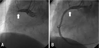 We did not find results for: Journal Of Lipid And Atherosclerosis