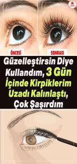 Guzellestirmesi Icin Kullandim Hem Guzellestirdi Hemde Kirpiklerimi Uzatip Kalinlastirdi Bu Kadarini Ben Bile Beklemiy Kirpik Cilt Beyazlatma Cilt Tedavileri