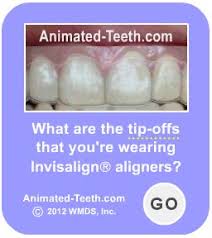 Jul 13, 2019 · for example, for people struggling with a frontal lisp, a technique known as the smiling method can help alleviate symptoms. Invisalign Lisp Speech Problems Occurrence Rates Cures