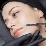 Dermaplaning