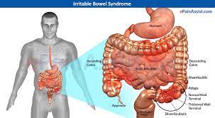 Add Qualifying Condition Irritable Bowel Syndrome Ibs Arkansas Cannabis Industry Association