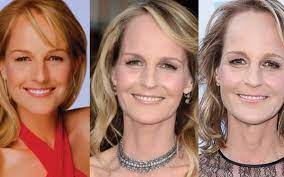Helen hunt is also linked with rumors of using botox injections on her face. Helen Hunt Plastic Surgery 2021