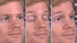 With tenor, maker of gif keyboard, add popular super happy meme face animated gifs to your conversations. Blinking White Guy The Story Behind The Meme That S Gone Viral Science Tech News Sky News