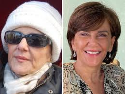 Imágenes del día: Carla Barber muestra el brutal cambio de su madre tras  pasar por su clínica estética