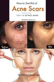 It also has an astringent property that can tighten the pores and remove bacteria dust. Pin On Beauty World