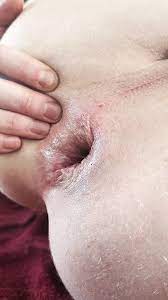 xHamster