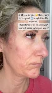 Stephanie Walz Vining (@stephanievining_hormonehealth) · San Diego, CA