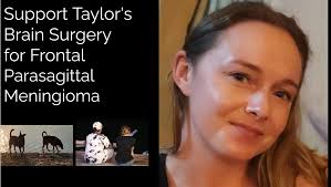 Fundraiser by Taylor Stuart : Support Taylor's Surgery for Frontal  Parasagittal Meningioma