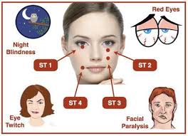 Stomach Meridian Points St1 St2 St3 St4 And Their