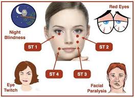 Stomach Meridian Points St1 St2 St3 St4 And Their