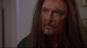 Baldy” The Film Is A Hilarious & Relatable Journey To Self-Acceptance