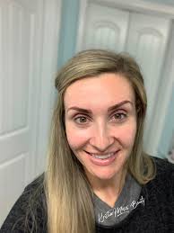 BBL and Moxi laser treatment for glowing skin