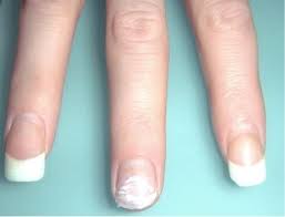 Should i wear acrylics after i get pregnant? My Worst Nail Mistake Learn 5 Reasons I Am Never Wearing Acrylics And Why You Shouldn T Either Beauty Harbour