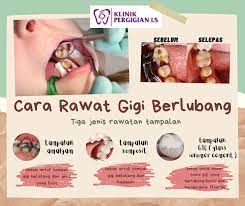 Masuk dan terus ke kaunter pendaftaran. Jangan Biarkan Gigi Anda Berlubang Ls Dental Clinic Facebook
