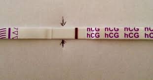 Pin On Pregnancy