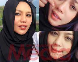 Check spelling or type a new query. Dari Buat Hidung Baik Aku Buang Lemak Sungguh Kenyataan Zulin Aziz Memang Win Habis Media Hiburan