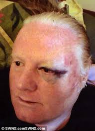 Elderly Bristol couple in fear after thug who put them in hospital moves in  3 doors away