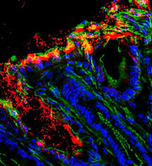 In Response To A Bacterial Infection An Immune Signal In Mice S Guts Triggers A Molecular Cascade That Promotes Diar Bacterial Infection Image Of The Day Guts
