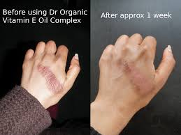 Dr Organic Vitamin E Pure Oil A Solid Middle Range Contender