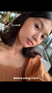 Softie Myra Chrome Body