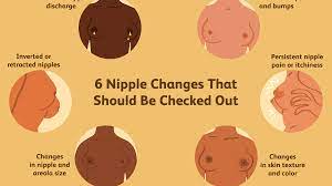 Nipple And Areolar Changes What S Normal What S Not