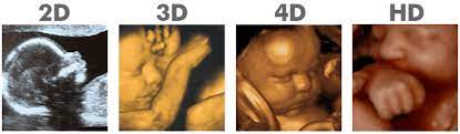 Faq S 2d 3d 4d Hd Elective Ultrasound Studio East Longmeadow Ma