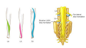 Pin On Nursing Iv