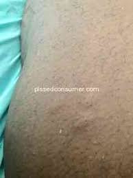 Along with a sofa, bed, box spring, and area rug, you can also find a large variety of popular raymour & flanigan offers a large popular brand selection. Raymour And Flanigan Bed Bugs Beware Sep 22 2019 Pissed Consumer