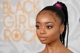 Bantu knots on very short hair is a clear demonstration of how fashionable african women are when it comes to read also: Bantu Knots And Baby Hairs Our Favorite Looks From The Black Girls Rock Awards Show Chicago Tribune