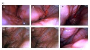 Toutefois, il est important de nettoyer la. Progres Dans L Insemination Artificielle Chez Les Truies Nullipares Articles 3trois3 Le Site De La Filiere Porc