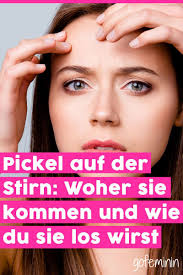 Selbst wenn sie unabhängig die ursache für ihr aussehen festgestellt haben. Pickel Auf Der Stirn Woher Sie Kommen Und Wie Du Sie Loswirst Pickel Stirn Pickel Tipps Gegen Pickel