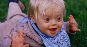 Otistik çocukların beyinleri daha büyük