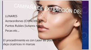 Fisio Sbeltic ivirgarzama