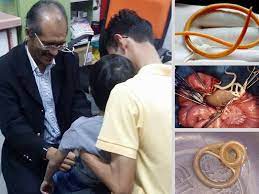 Manusia berinteraksi dengan cacing kerawit. Bahaya Rupanya Jangkitan Cacing Ni Boleh Akibatkan Anemia Ganggu Tumbesaran Anak Mingguan Wanita