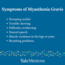 Image result for Muscle Weakness Causes